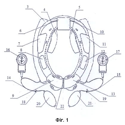 Корисна модель «ДИСТРАКЦІЙНО-ФІКСУЮЧИЙ КОМІР», патент №163589